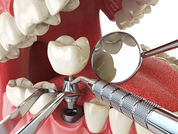 Best Mobile Emergency Dentist in Bellflower, CA
